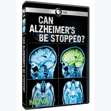 NOVA: Can Alzheimer's Be Stopped DVD - AV Item